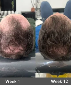 LOVILDS® Highly Effective Biotin & Rosemary Hair Growth Serum