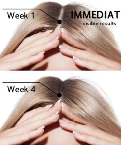 LOVILDS® Highly Effective Biotin & Rosemary Hair Growth Serum