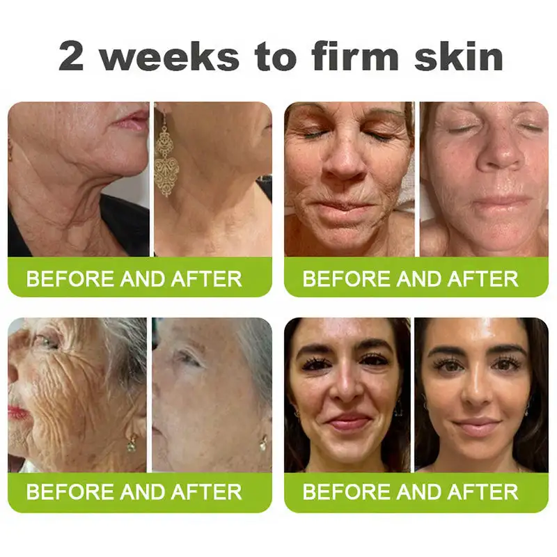 LOVILDS® Wrinkle-Lift Tightening Cream See firmer, smoother skin in as little as 3 days