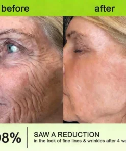 LOVILDS® moringa Vita-A Retinol Shot Wrinkle-Lift Tightening cream - Last Day Promotion 50 OFF