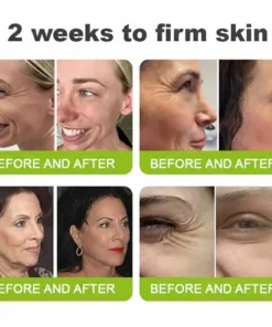 LOVILDS® moringa Vita-A Retinol Shot Wrinkle-Lift Tightening cream - Last Day Promotion 50 OFF