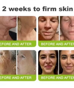 LOVILDS® moringa Vita-A Retinol Shot Wrinkle-Lift Tightening cream - Last Day Promotion 50 OFF