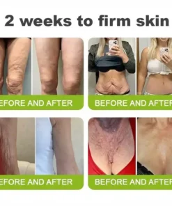 LOVILDS® moringa Vita-A Retinol Shot Wrinkle-Lift Tightening cream - Last Day Promotion 50 OFF