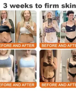 LOVILDS®Tightening Burn Gold Massage Cream