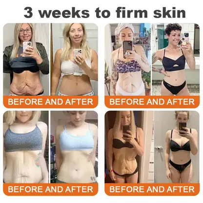 LOVILDS®Tightening Burn Gold Massage Cream