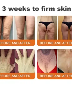 LOVILDS®Tightening Burn Gold Massage Cream