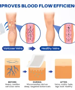 LOVILDS® 𝑽𝗲𝗶𝙣 𝘾𝐨𝐧𝘁𝗼𝙪𝙧 𝙈𝙞𝐜𝐫𝒐𝒏𝒆𝗲𝗱𝗹𝙚 𝙋𝙖𝐭𝐜𝒉