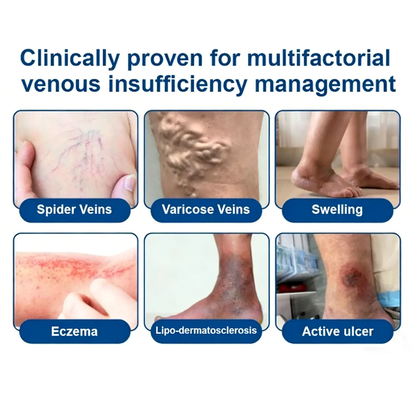 LOVILDSยฎ ๐ฝ๐ฒ๐ถ๐ฃ ๐พ๐จ๐ง๐๐ผ๐ช๐ง ๐๐๐๐ซ๐๐๐๐ฒ๐ฑ๐น๐ ๐๐๐ญ๐๐