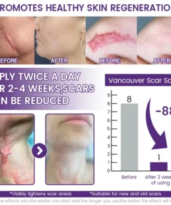 LOVILDS™ ReGenScar Stem Cell Repair Gel