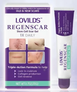 LOVILDS™ ReGenScar Stem Cell Repair Gel