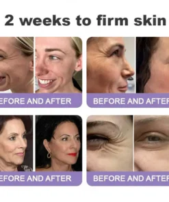 LOVILDS® Skin Tightening & Vita-A Retinol Retinol shot Anti-Wrinkle Firming Tightening cream