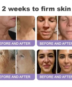 LOVILDS® Skin Tightening & Vita-A Retinol Retinol shot Anti-Wrinkle Firming Tightening cream