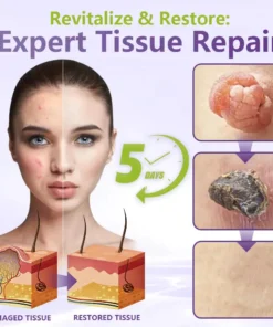 LOVILDS™ SOLUBLE MICRONEEDLE BOTANICAL SKIN TAG REMOVAL PATCH