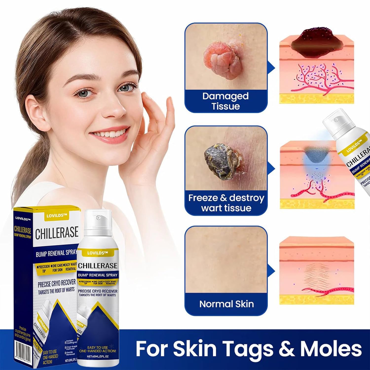 LOVILDS® Skin Renewal Spray for Skin Bumps - Image 3
