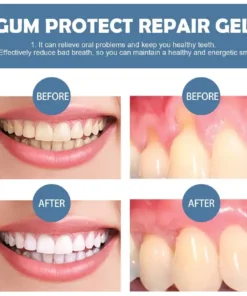 LOVILDS® Gum Protect Repair Gel