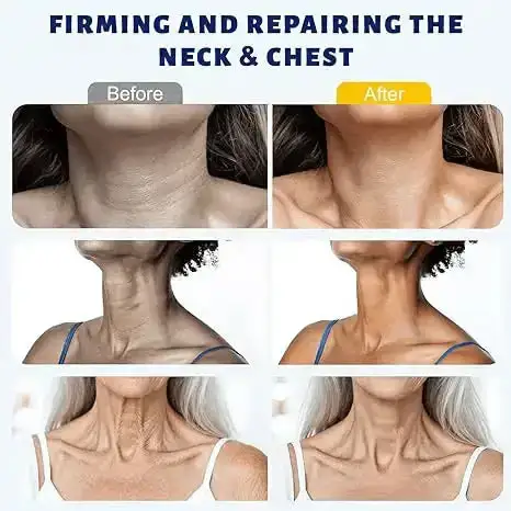 LOVILDS™ Instant Neck Lift Cream