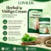 LOVILDS® Targets Vitiligo