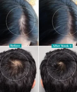 LOVILDS™ Advanced Hair Density Roll-On Serum