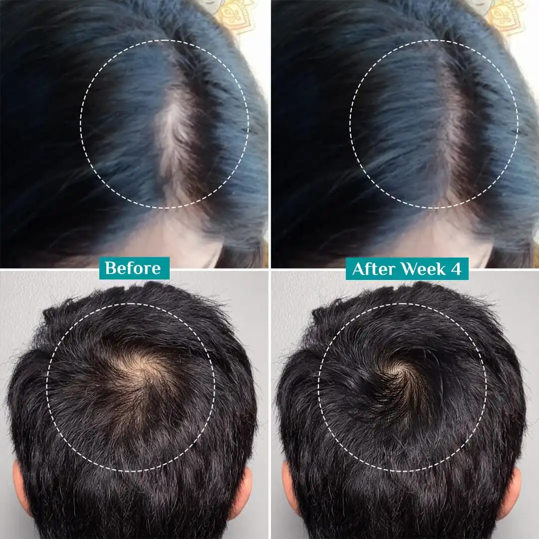 LOVILDS™ Advanced Hair Density Roll-On Serum