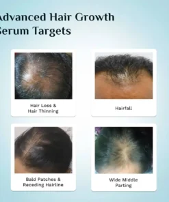 LOVILDS™ Advanced Hair Density Roll-On Serum