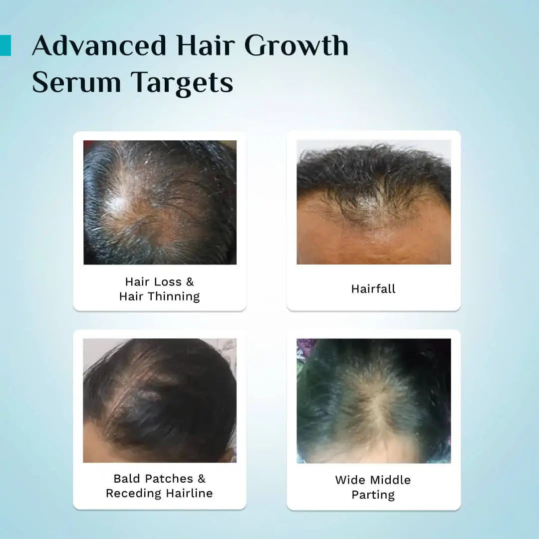 LOVILDS™ Advanced Hair Density Roll-On Serum
