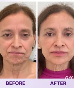 LOVILDS® Instant Lift Eye Gel