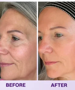 LOVILDS® Instant Lift Eye Gel