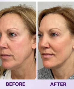 LOVILDS® Instant Lift Eye Gel