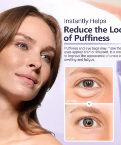 LOVILDS® Instant Lift Eye Gel