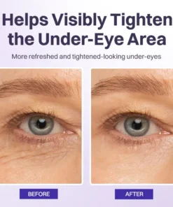 LOVILDS® Instant Lift Eye Gel