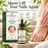 LOVILDS™ Tea Tree Nail Renewal Serum