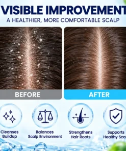 LOVILDS Scalp Soothing Cream